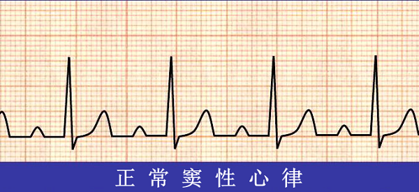 救命神器AED有多重要——你认识它吗？(图6)
