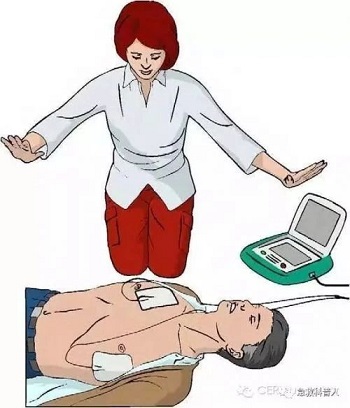 救命神器AED有多重要——你认识它吗？(图24)